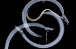 78 ülkede tespit edildi! Kontrolden çıkabilir: Cinsel organlara yerleşip…