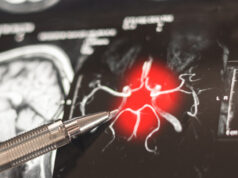 Alzheimer’da ‘gizli evre’ keşfedildi: Belirtiler 50’li yaşlarda başlıyor!