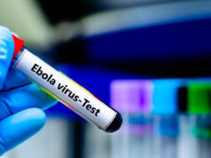 İsrail’de ilk kez Ebola şüphesiyle bir kişi karantinaya alındı