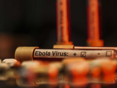 Ölümcül Ebola Avrupa’ya sıçradı!